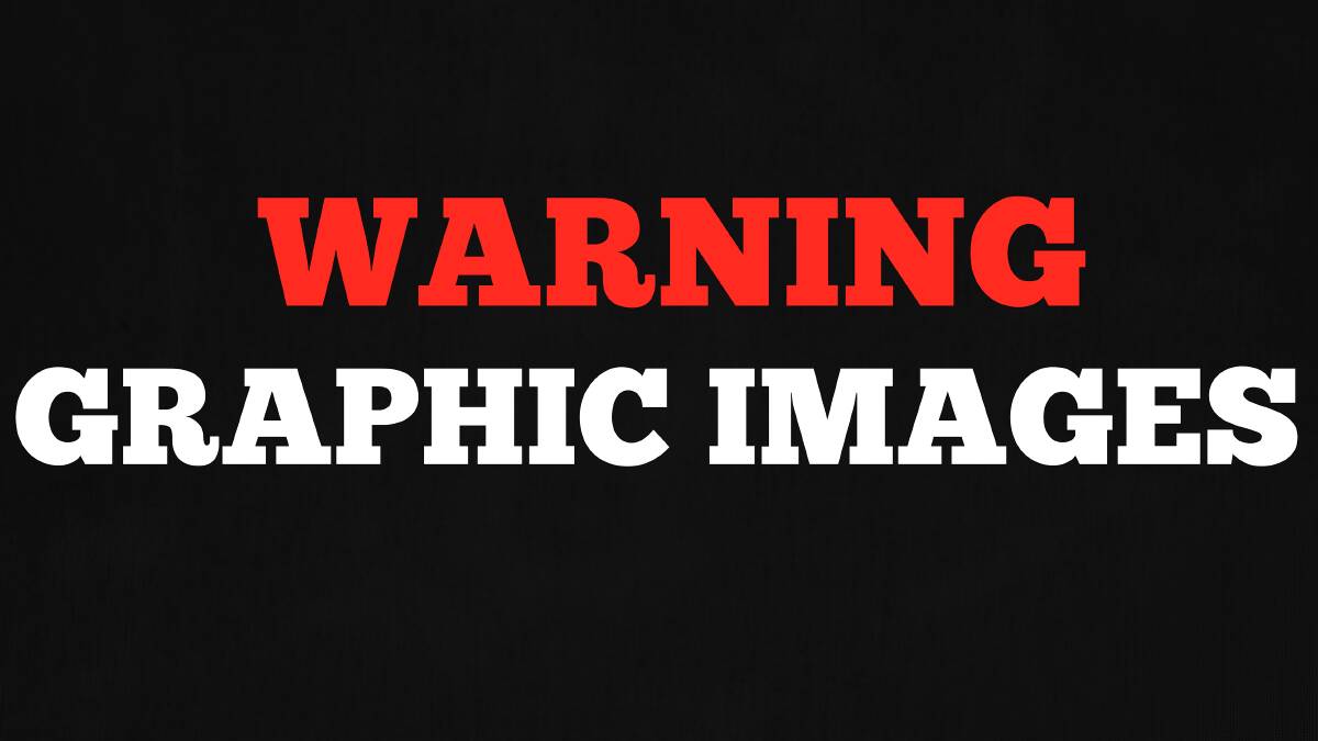 Warning: graphic images.