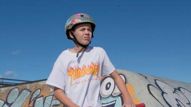 Ethan Wright's accident happened when he wasn't wearing his helmet. Photo: Louise Kennerley
