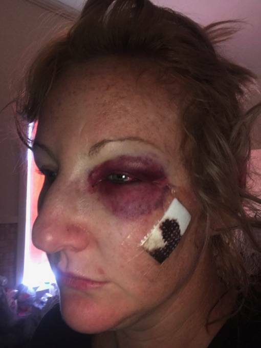 Off-duty cop investigated over fight that injures woman