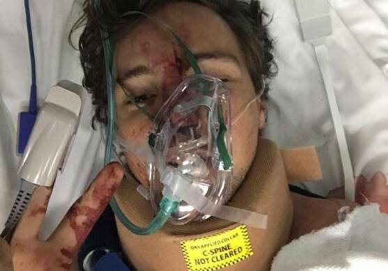 IN HOSPITAL: Rob Kellett in hospital after being hit by a car on an Ormiston street. A man has appeared in court on four charges relating to the incident. Photo: Supplied
