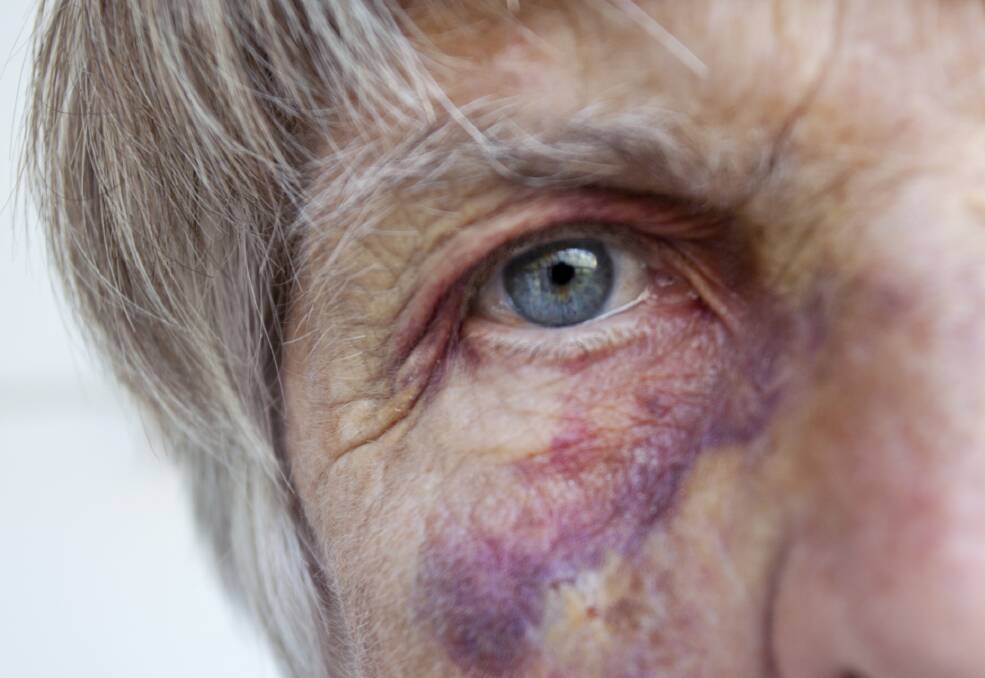 Various forms: Elder abuse is occurring in the south-west. Police urge elderly people who are being abused to speak out.