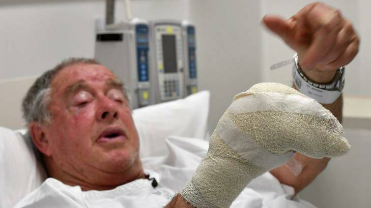 Rod McFarlane recovers from his injuries in The Alfred hospital. Photo: Joe Armao