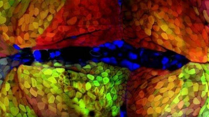 Stem cells at work in the zebrafish. Photo: Australian Regenerative Medicine Institute
