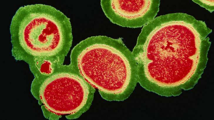 Resistant Staphylococcus bacteria. Photo: Science Photo Library