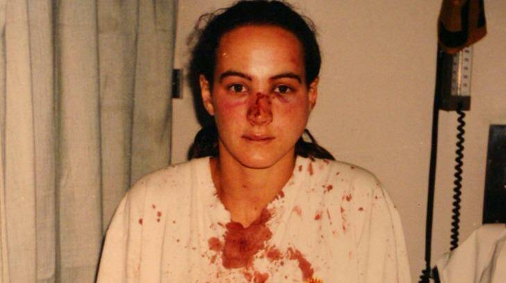 Corina Horvath in hospital in 1996. Photo: Nic Kocher