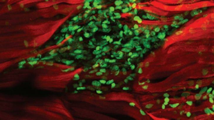 The images are part of world-first research. Photo: Australian Regenerative Medicine Institute