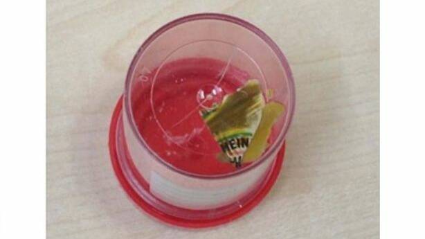 A piece of 'Heinz' plastic that was lodged in a woman's small intestine. Photo: BMJ Case Reports

