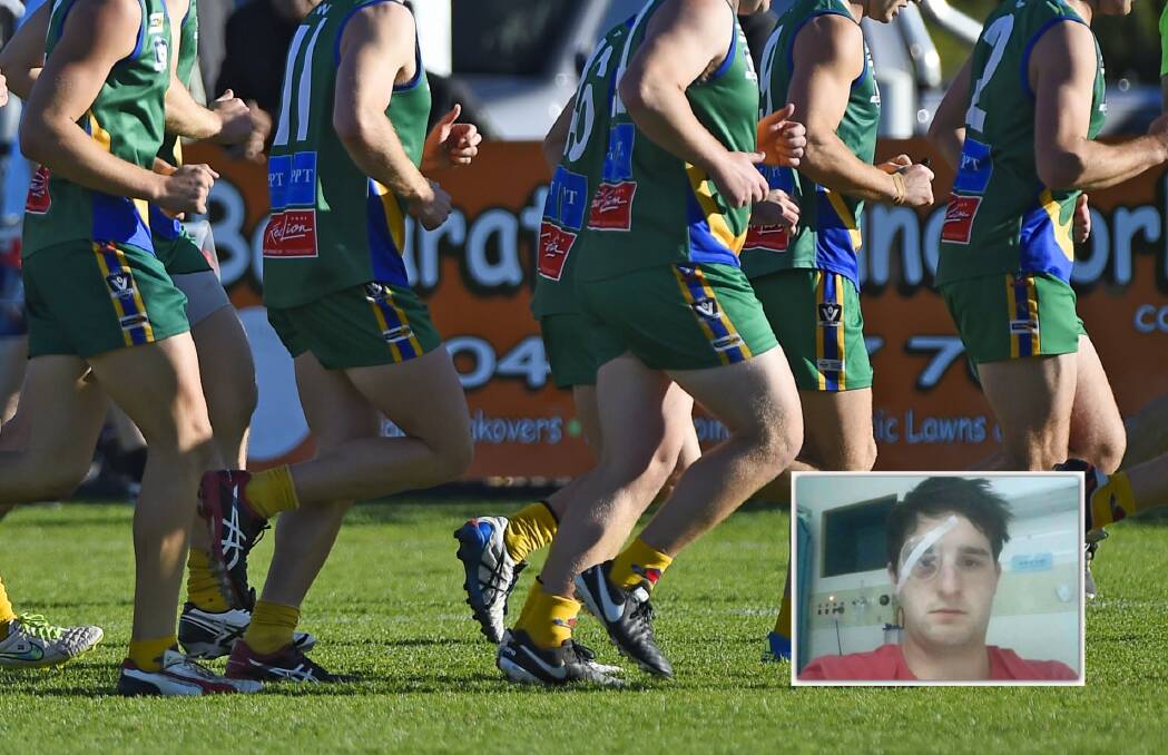 Former Lake Wendouree player sues club over ‘Silly Sunday’ egg throwing incident