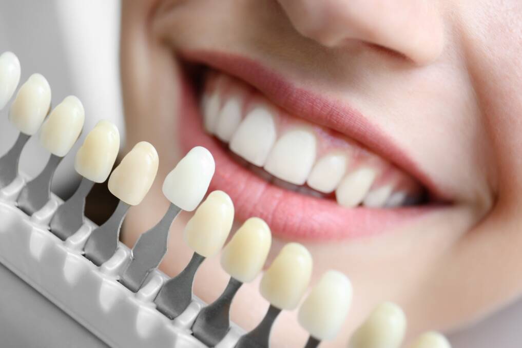 What are the benefits of teeth whitening
