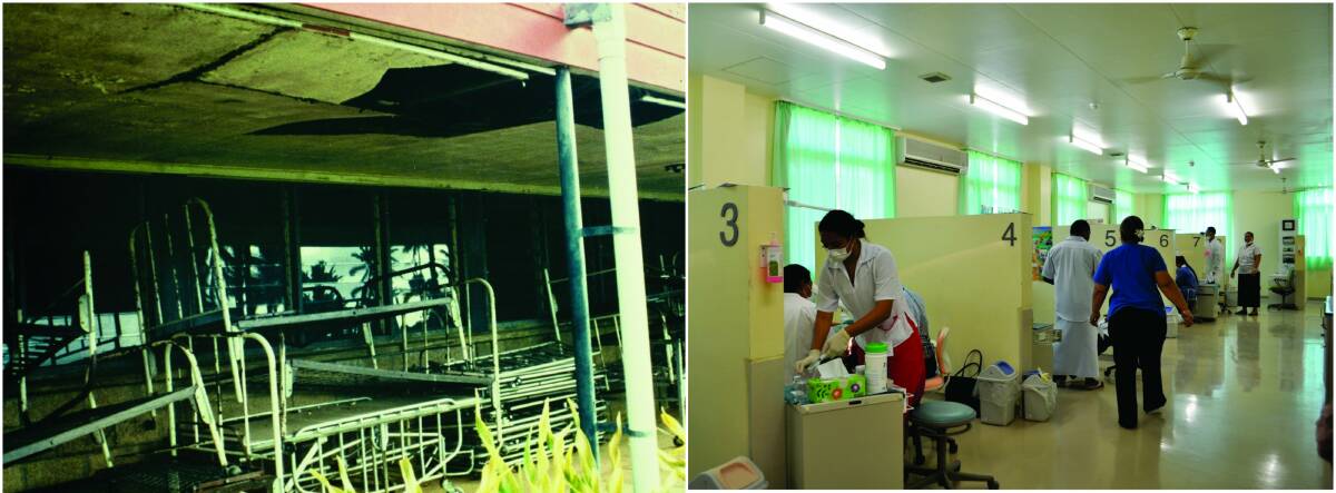 THEN AND NOW: Obsolete beds under a leaking roof (left) were a common sight at the hospital in 1991 and (right) compared to the modern dental wards in the hospital today.