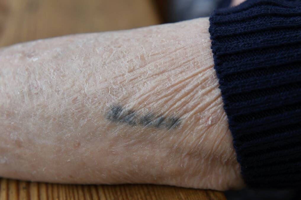 82617: Now blurred and barely readable, Maria Bezic received this identification tattoo on her arrival at Auschwitz in 1944. Picture: Lachlan Bence.
