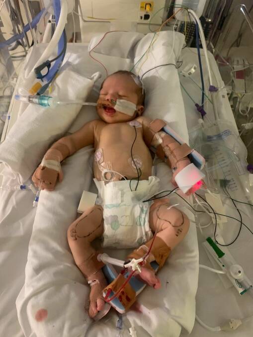 UPSETTING: Baby Cooper is hooked up to tubes and machines. Photo: Supplied