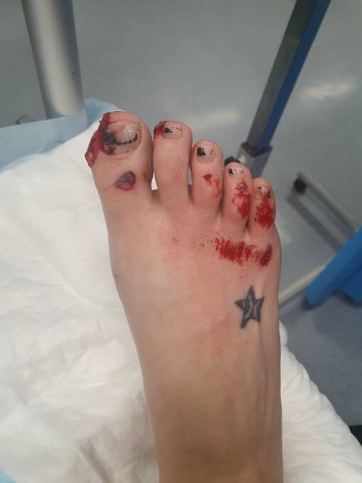 Samantha's injuries. Photos: Supplied