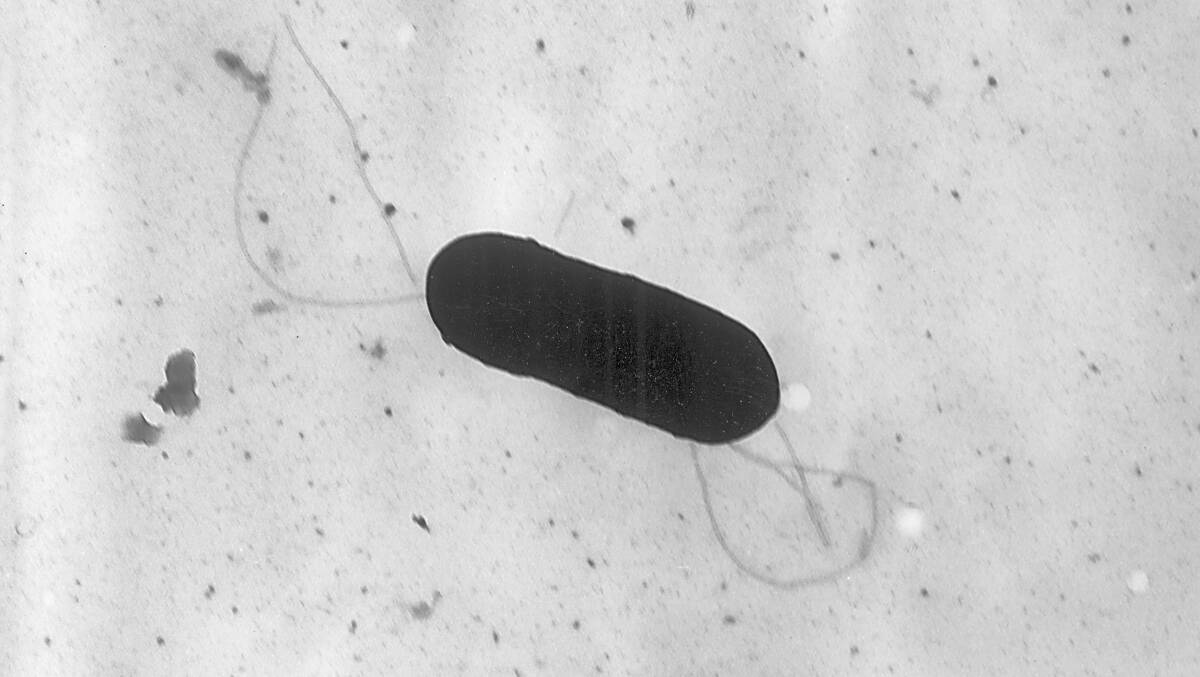 A microscopic view of the listeria bacteria. Picture: Elizabeth White/CDC via AP