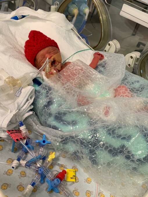 TINY: Lewis Delalande weighed just 763g and was 32cm long when he was born 15 weeks early. Picture: supplied