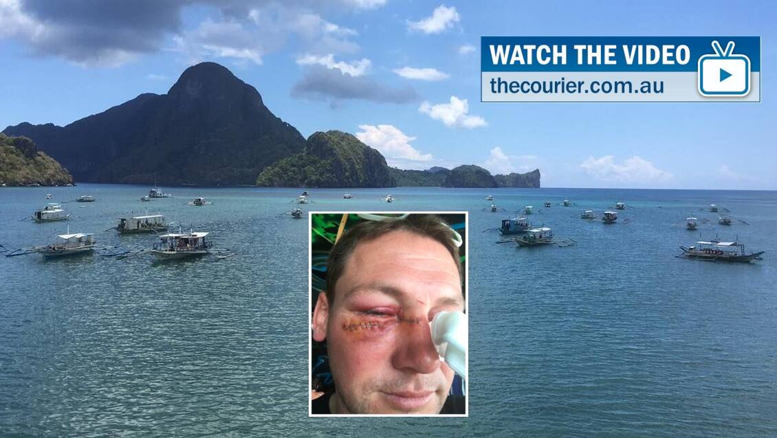 PARADISE: The view of El Nido from Shaun Boag's Submariner Diving Centre and (inset) the horrific eye injury he suffered when a ceiling fan broke. 