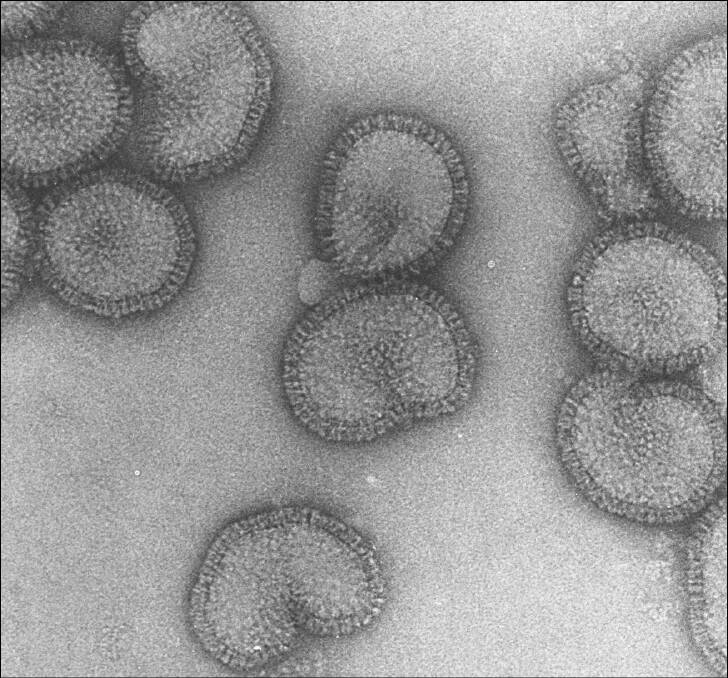 An electron microscopy image of the flu virus