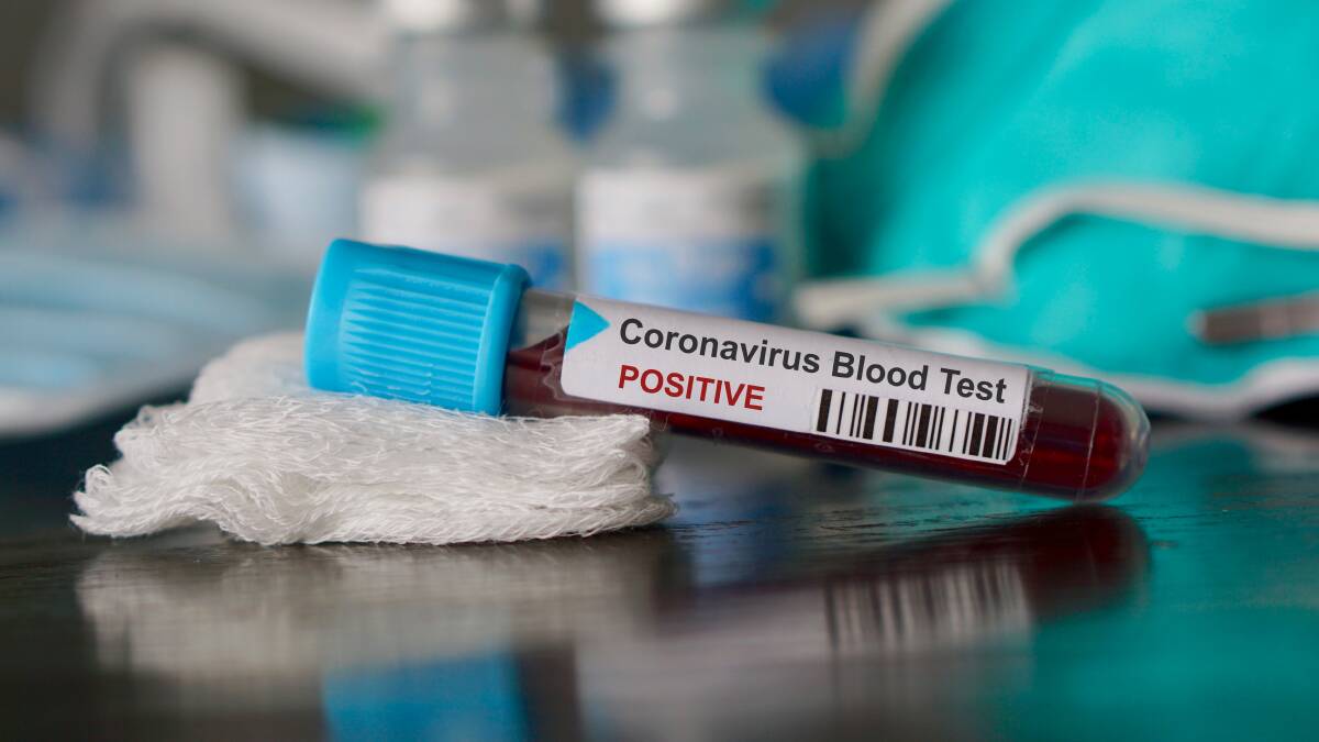 What might trigger a return to 'normal'? Why our coronavirus exit strategy is ... TBC