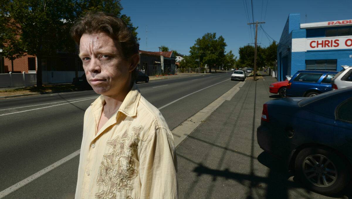 King-hit victim Daniel Lock has spoken out about street violence in Ballarat. PICTURE AND VIDEO: ADAM TRAFFORD
